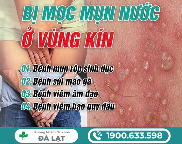 Hình ảnh minh họa